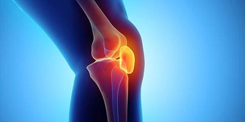 orthopaedic